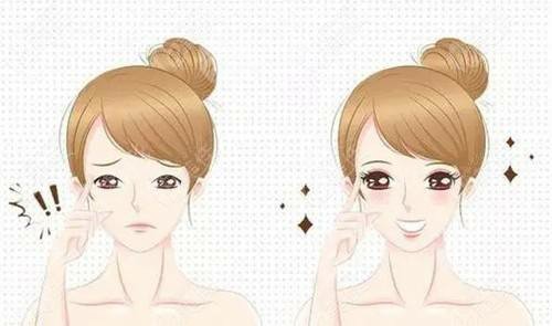 溢美医疗美容双眼皮案例