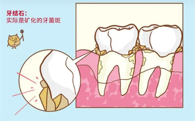 上海永颜口腔诊所口碑如何？技术是否可信赖？有实例分享吗？