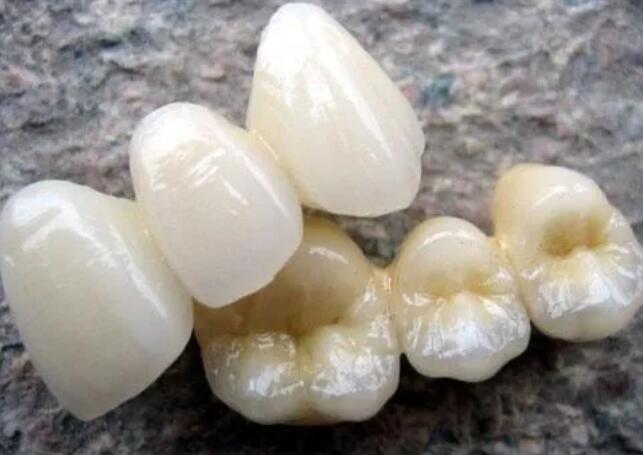 上海摩尔口腔拔智齿操作是否安全可靠？