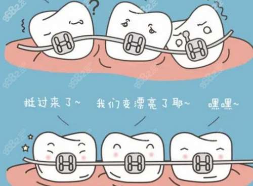 威海牙齿修复：补牙多少钱一颗，材料更新换代