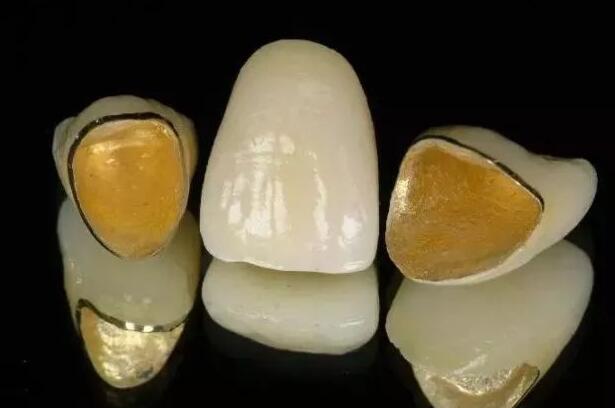 上海哪家牙科医院种牙好？排名高的口腔医院推荐！