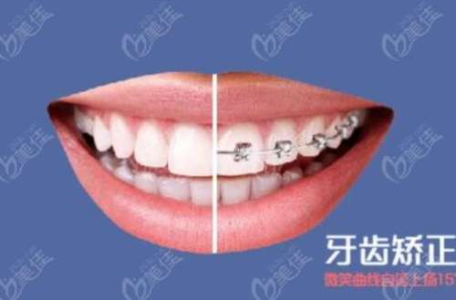 重庆烤瓷牙技术排名TOP3正规医院！了解这两家口腔机构