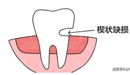 了解一下：假牙价格、作用和副作用详解！