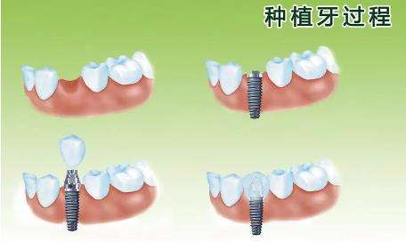 北京比较好的三甲口腔医院推荐，揭秘五家医院实力！