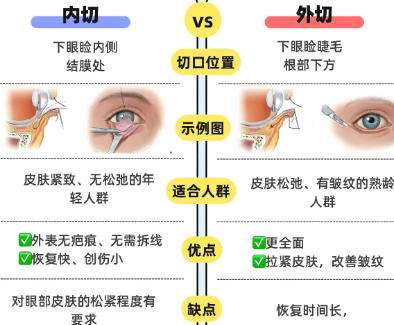 去眼袋