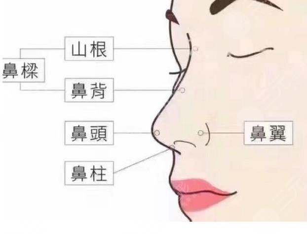 隆鼻