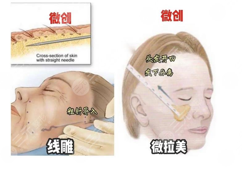 厦门思明薇格整形外科门诊部相关技术介绍