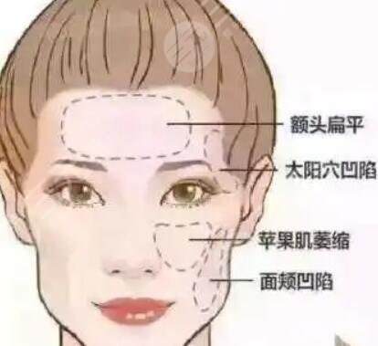 美易美时代医疗美容去颈纹经历