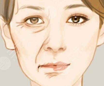 莱芜微整形医院面部抗衰案例