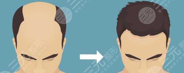 上海华美植发中心正规吗