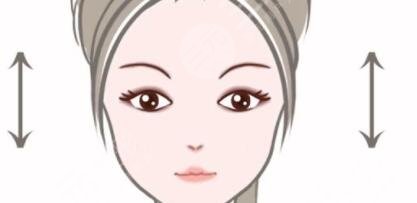 双眼皮手术后