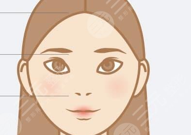 瑞美瑞亚整形医院隆鼻案例