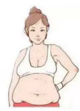 粤北人民医院整形美容科吸脂案例