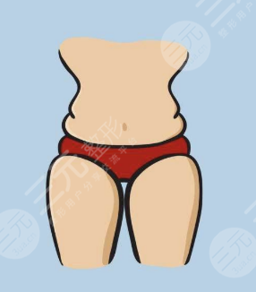 北京清菡医疗美容大腿吸脂案例