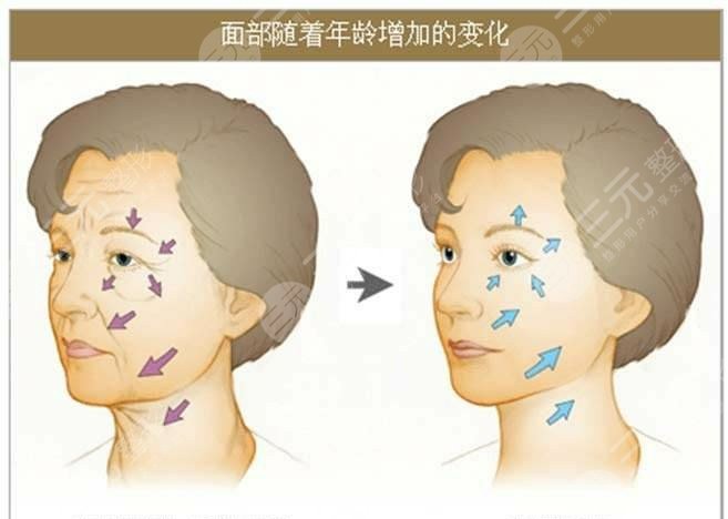长治市医院美容科主任李学雷案例