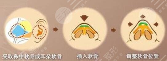 深圳艺星医疗美容整形医院擅长项目：