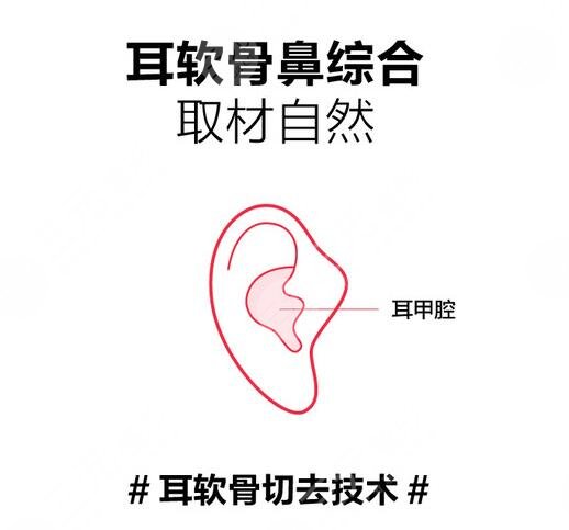 成都武侯素美天资相关技术介绍