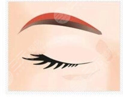 合肥曙光植发医院眉毛种植案例分享