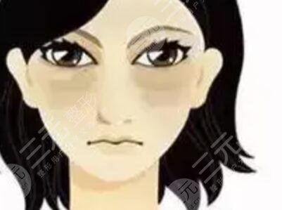 溪峰聚美仕祛眼袋案例