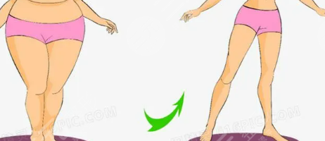 上海安缦医疗美容门诊腹部吸脂手术后3个月
