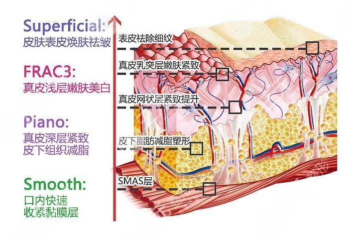 上海美莱整形美容医院Fotona4D科普