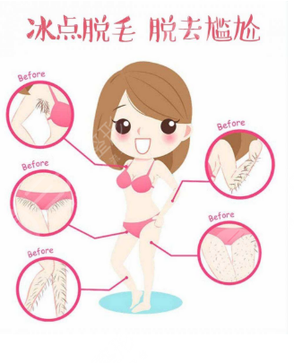 激光腋下脱毛的原理