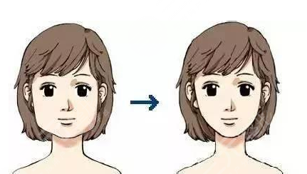 上海时光整形医院磨骨科普知识