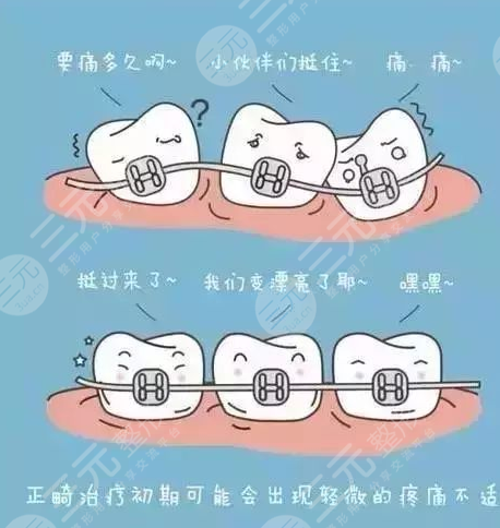牙齿矫正