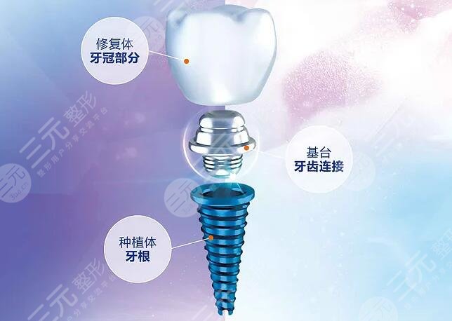 10家！北京十大种植牙排名：中诺口腔|品格口腔|北京口腔等，榜上有名