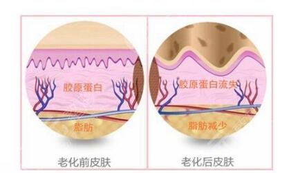 热玛吉果