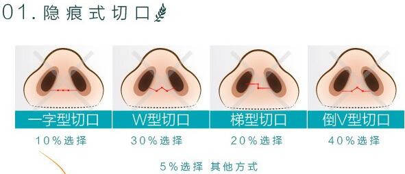 联合丽格医院科普隆鼻手术