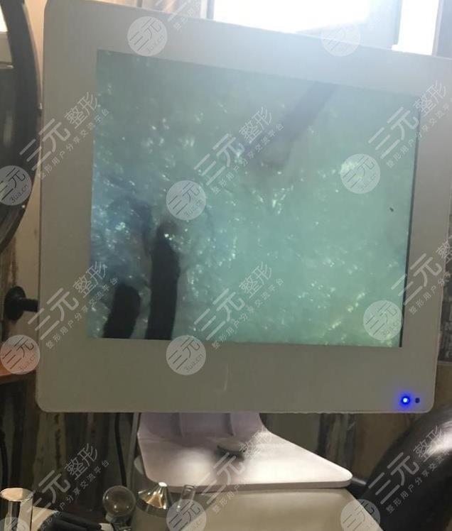 广州仁健头皮护理经历