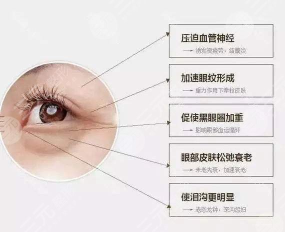 去眼袋之前