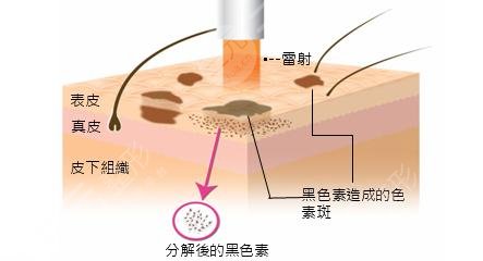 2020滨州人民医院美容科价格来喽，附祛斑祛痘祛疤技术科普