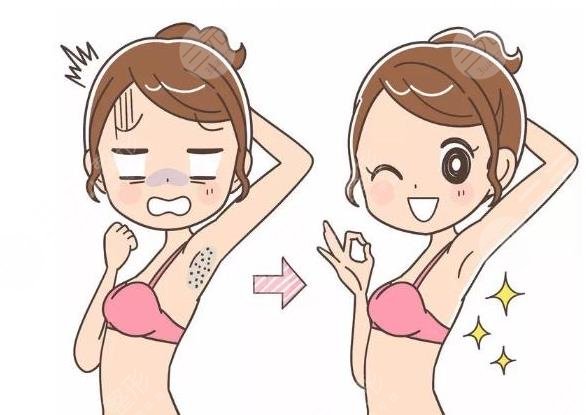 天津医科大学总医院整形美容外科激光脱毛经历