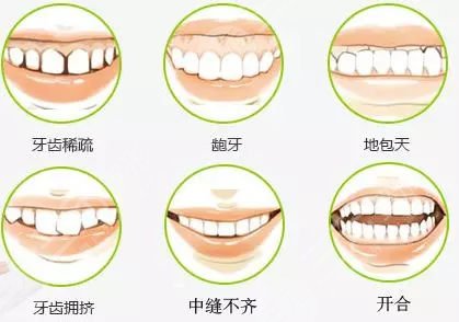 牙齿矫正的价格