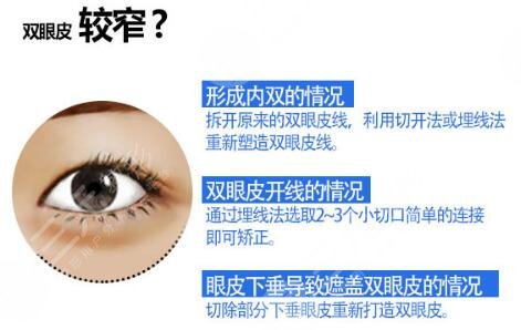 河科大第一附属医院整形美容科讲解手术知识