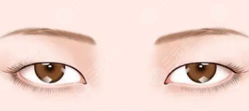 上海千美医疗美容院眼部整形前
