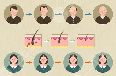 雍禾医院是正规的吗?治疗脱发怎么样?口碑怎么样?