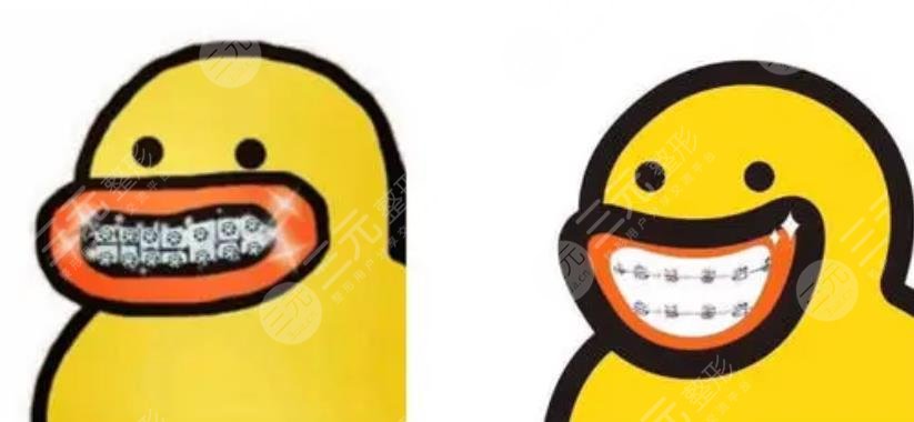 广医三院口腔科牙齿矫正案例
