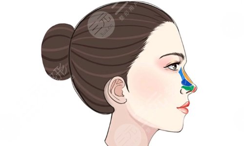沈阳名流美容医院隆鼻怎么样？