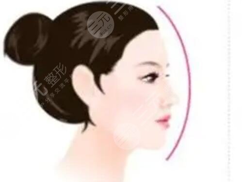 薇拉医疗整形隆鼻案例