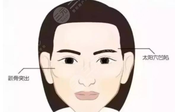 面部脂肪填充