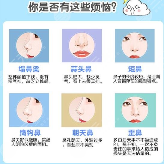 隆鼻项目