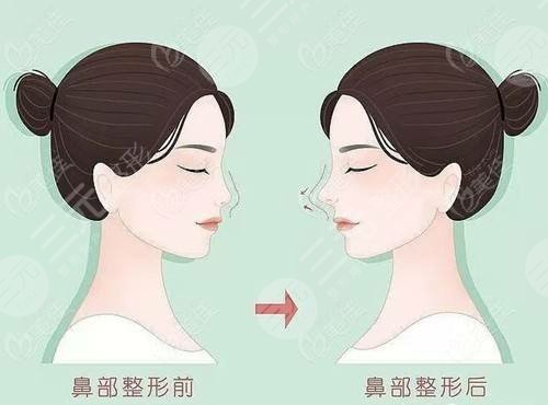 名丽医美怎么样