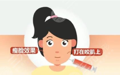 注射瘦脸