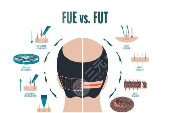 成都植发医院排行:实力派靠谱植发机构盘点~
