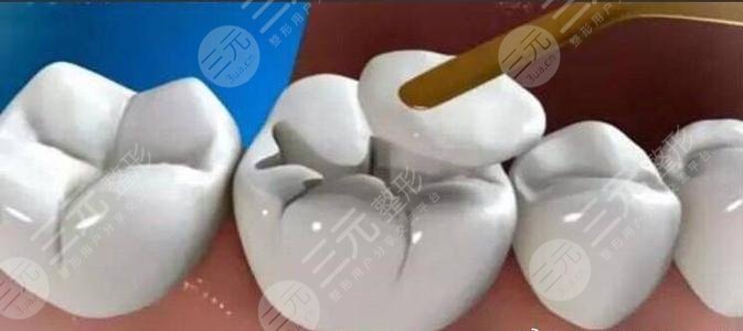乌鲁木齐军区总医院牙科开展的项目有哪些?