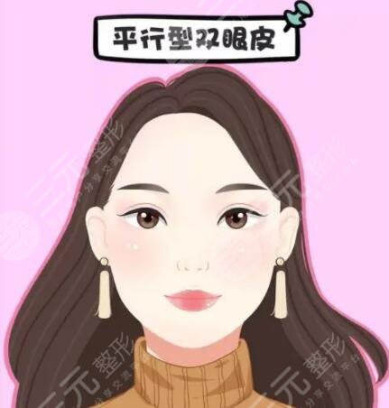 恩喜医疗美容医院割双眼皮案例