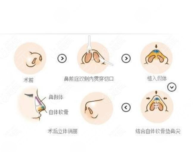 兰大一院整形外科特色项目信息科普